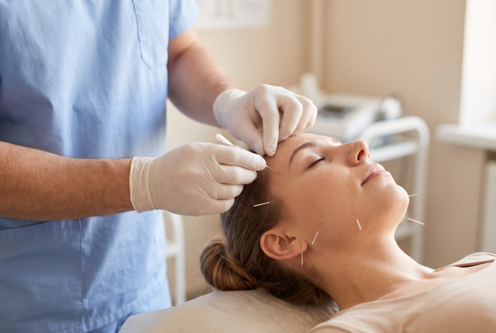 Dry needling treatment applied to a patient's jaw, cheek, and ear area for TMJ-related muscle tension